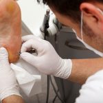 purulent drainage pictures 03