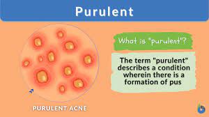 purulent drainage