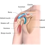 Demystifying SLAP Tear Shoulder Injuries: Causes, Symptoms, and Treatment slap tear shoulder