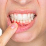 Sore Gums: Causes, Treatment, and Oral Health Tips for Relief sore gums