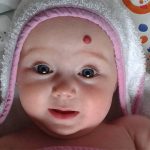 Demystifying Strawberry Birthmarks: Causes, Types, and Treatment strawberry birthmark