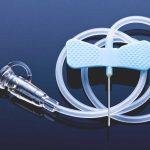 Managing Bladder Health: All You Need to Know About Suprapubic Catheter suprapubic catAheter