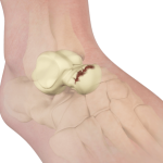 The Essential Guide to the Talus Bone: Structure, Function, and Common Conditions talus bone