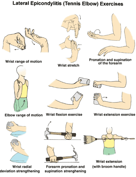 tennis elbow exercises