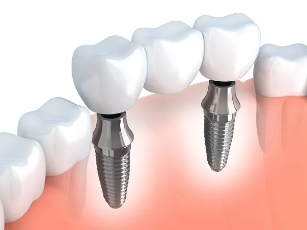 what is a periodontist