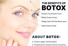 Beauty: Exploring the Benefits of Botox Benefits of Botox
