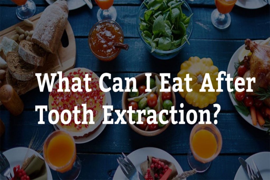 Can I Eat After Tooth Extraction