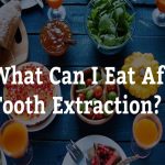 Can I Eat After Tooth Extraction? Your Diet Post-Surgery Can I Eat After Tooth Extraction