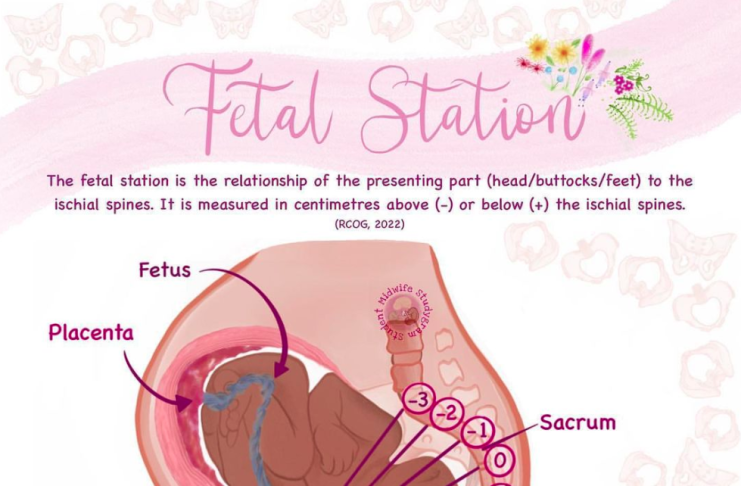 Fetus-2 Station