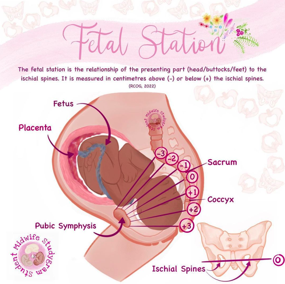 Fetus-2 Station