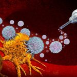Immunotherapy and Brain Tumors Immunotherapy and Brain Tumors
