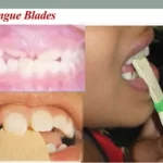 Versatility of the Tongue Blade: More Than Just a Medical Tool Tongue Blade
