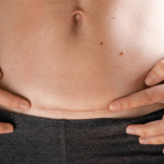 When Can I Safely Start Bending After a C-Section? When Can I Safely Start Bending After a C-Section