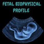 Demystifying the Biophysical Profile: A Window Into Fetal Health biophysical profile