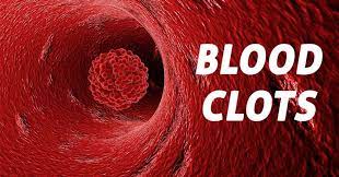 blood clot in finger