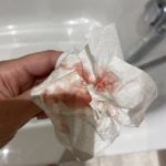 Concerns Blood When I Wipe blood when i wipe