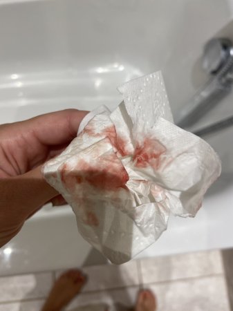 blood when i wipe