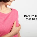 Decoding Breast Cancer Rash: Signs, Causes, and Strategies for Detection breast cancer rash