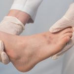 Navigating the Road to Recovery Dealing with a Broken Foot broken foot