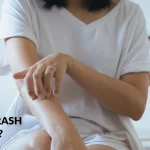 Decoding Cancer Rash: Symptoms, Causes, and Care cancer rash