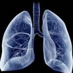 Demystifying Centrilobular Emphysema: Causes, Symptoms, and Management centrilobular emphysema