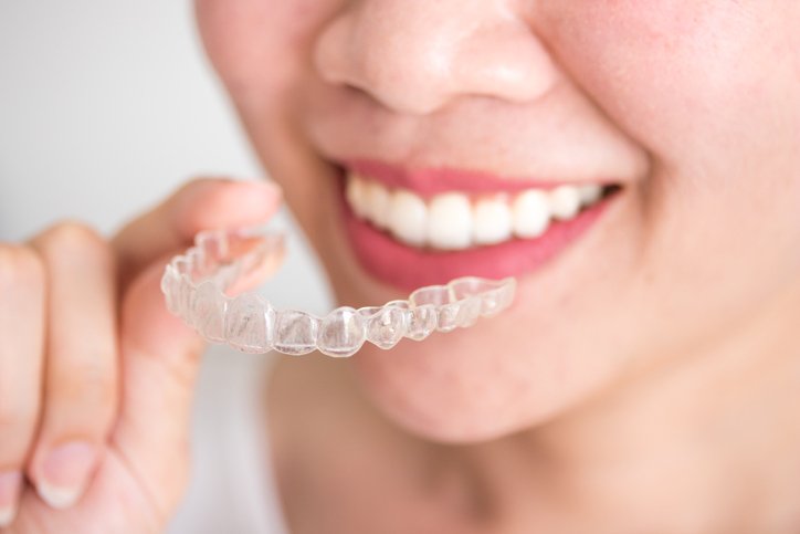 clear retainers