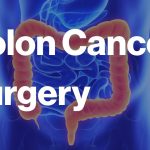 Empowering Recovery: Navigating Colon Cancer Surgery with Confidence colon cancer surgery