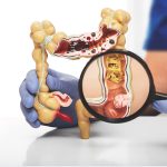 The Expert Guide to Colorectal Surgeons colorectal surgeon