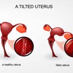Stomach Pain After Sex Is Pregnancy a Concern does stomach pain after sex mean your pregnant