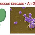 Enterococcus Faecalis: The Hidden Microbial Marvel enterococcus faecalis