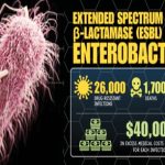ESBL Infection Causes, Symptoms, and Prevention esbl infection