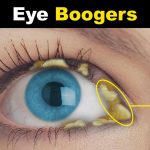 Dealing with Eye Boogers Causes, Prevention, and Easy Solutions eye boogers