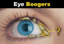 Dealing with Eye Boogers Causes, Prevention, and Easy Solutions eye boogers