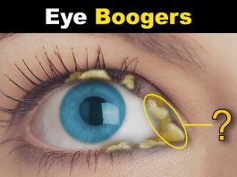 eye boogers