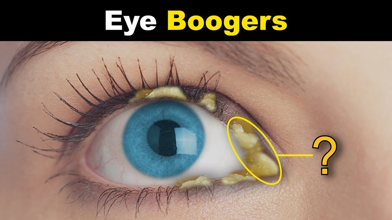 eye boogers