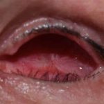 The Anatomy and Function of the Eye Socket eye socket