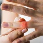 Finger Joint Pain: Causes, Symptoms, and Treatment Options finger joint pain