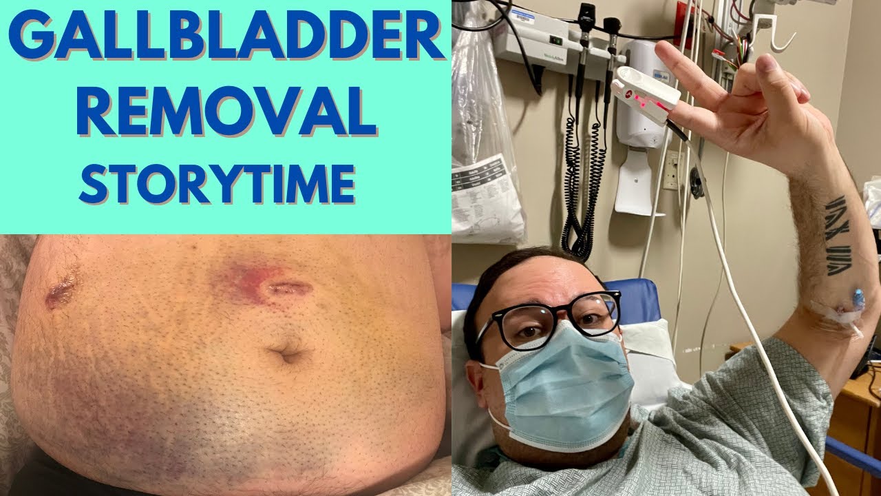 gallbladder surgery recovery