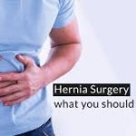 Mastering Hernia Surgery: A Comprehensive Guide to Recovery hernia surgery