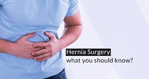 hernia surgery