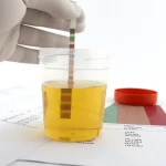 Cracking the Code of High pH in Urine: Causes and Solutions high ph in urine