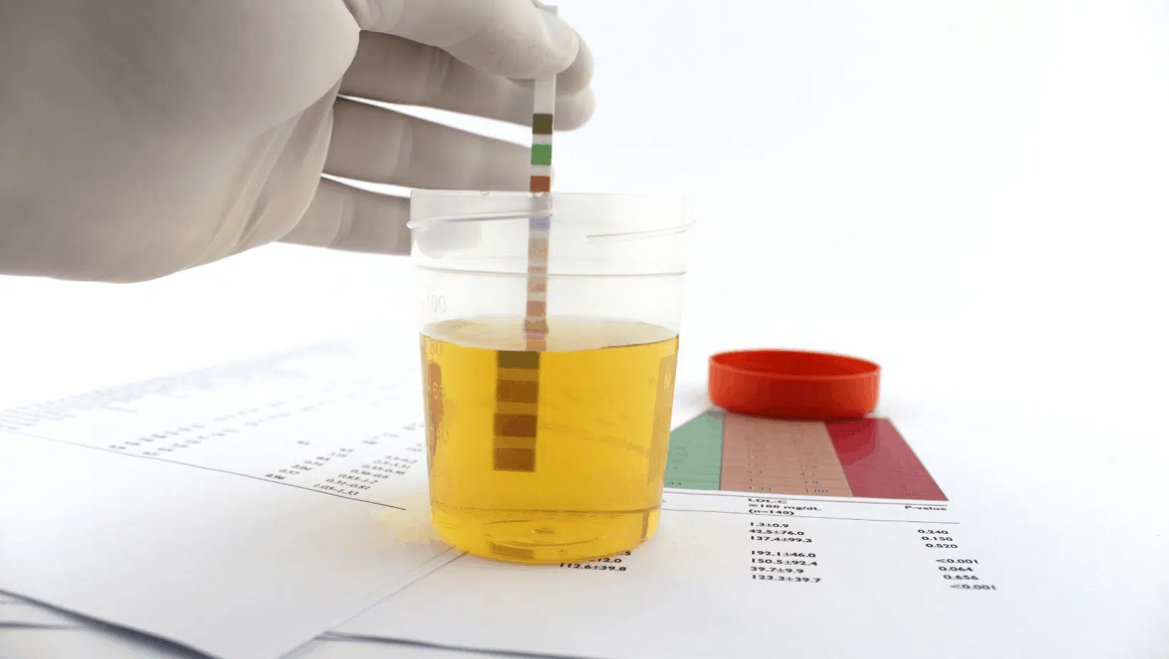 high ph in urine