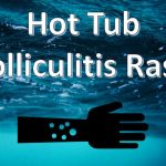Hot Tub Rash: Causes, Symptoms, Prevention, and Treatment hot tub rash