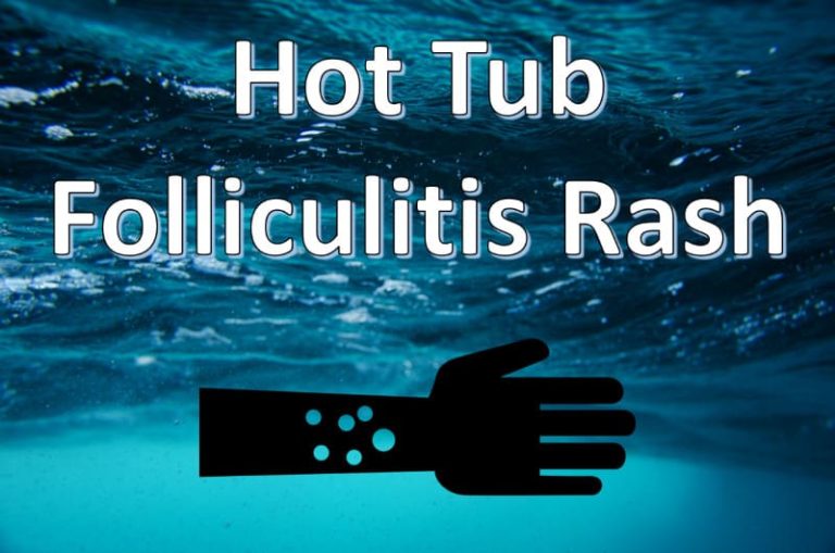 Hot Tub Rash Causes, Symptoms, Prevention, and Treatment