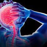 Demystifying Migraines: How Long Do Migraines Last? how long do migraines last