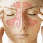 How Long Do Sinus Infections Last A Comprehensive Guide to Recovery how long do sinus infections last
