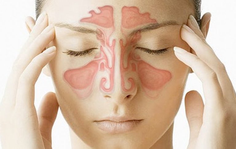 how-long-do-sinus-infections-last