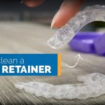 Mastering Oral Care How to Clean Retainer Effectively how to clean retainer