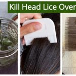 Quick and Effective: How to Get Rid of Lice Naturally in One Day how to get rid of lice naturally in one day