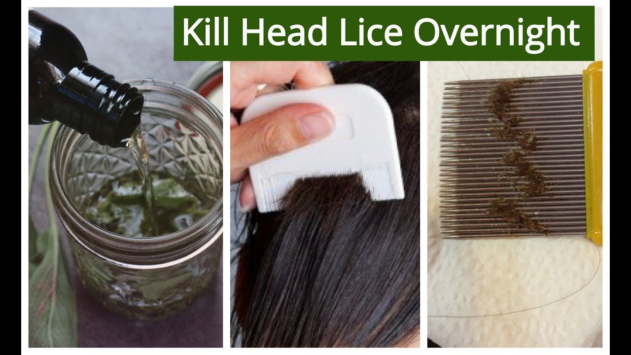 how to get rid of lice naturally in one day